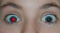 Free Red-eye Reduction Tool 2.0